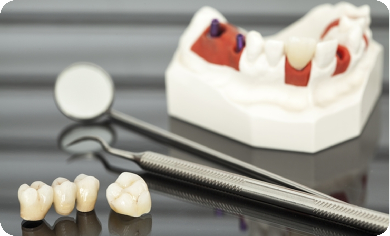Dental Crown And Bridge Treatment In Lahore