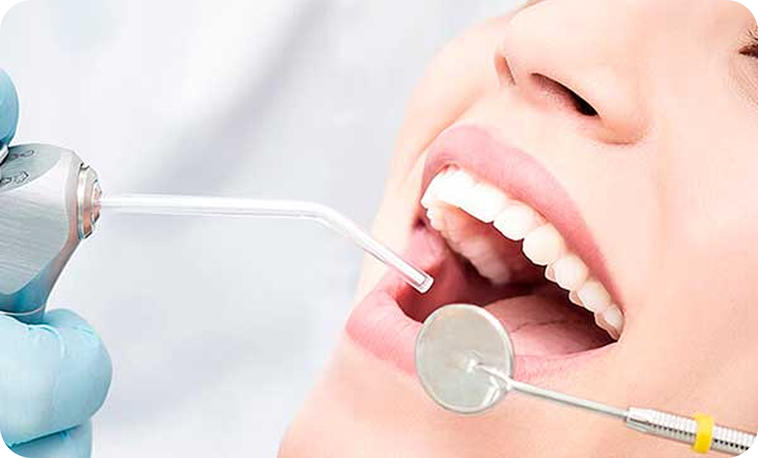 Dental Filling Treatment In Lahore