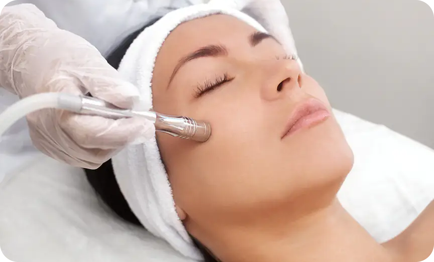 Microneedling With PRP For Acne Scars In Lahore