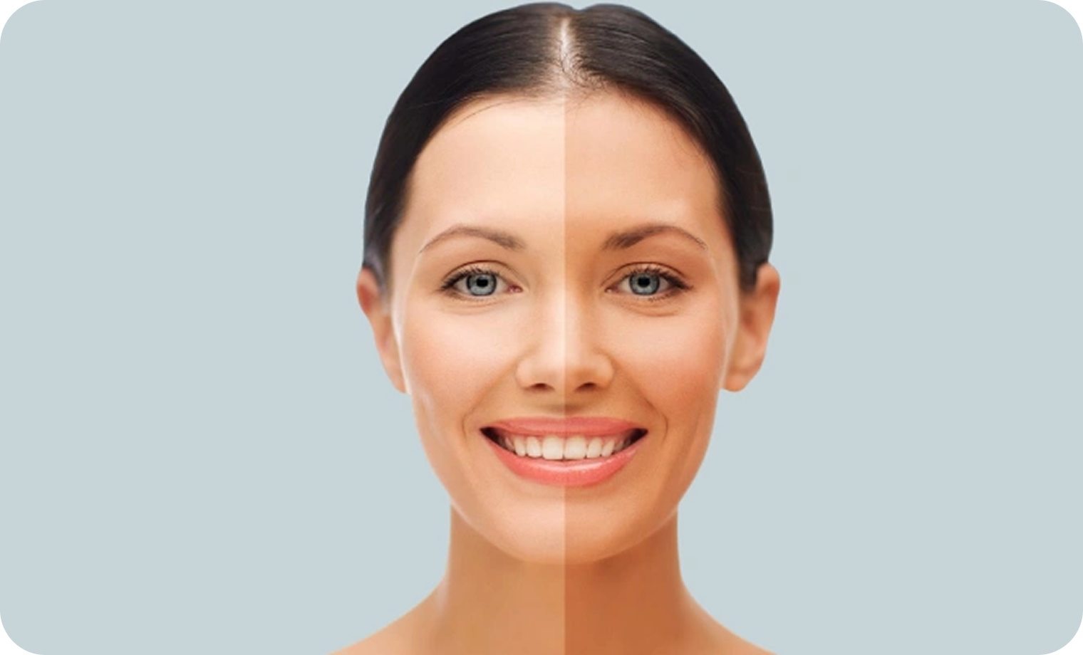 Skin Whitening Treatment