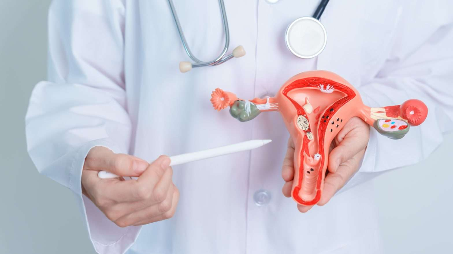 what-is-pcos-in-urdu