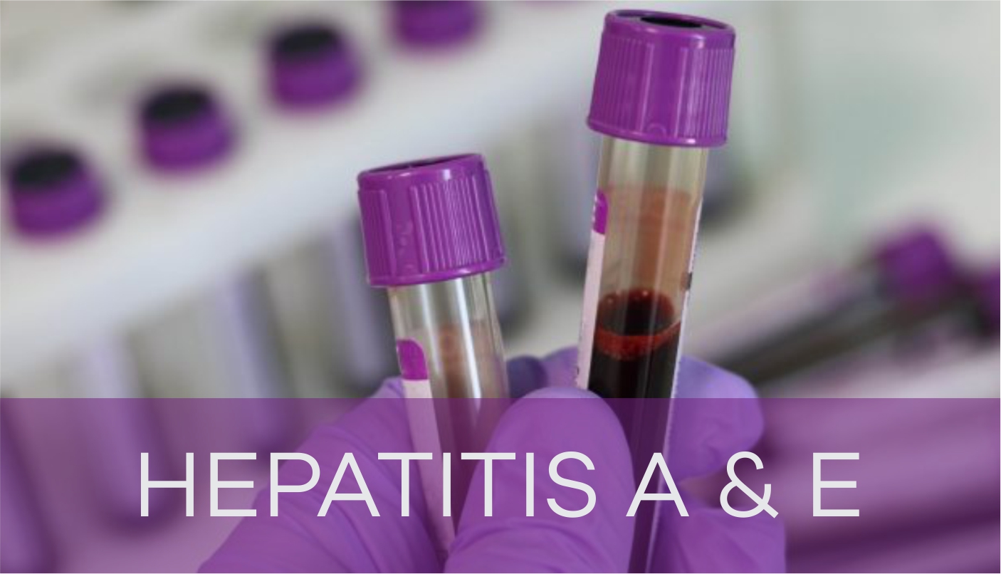 hepatitis-a-and-e-in-pakistan