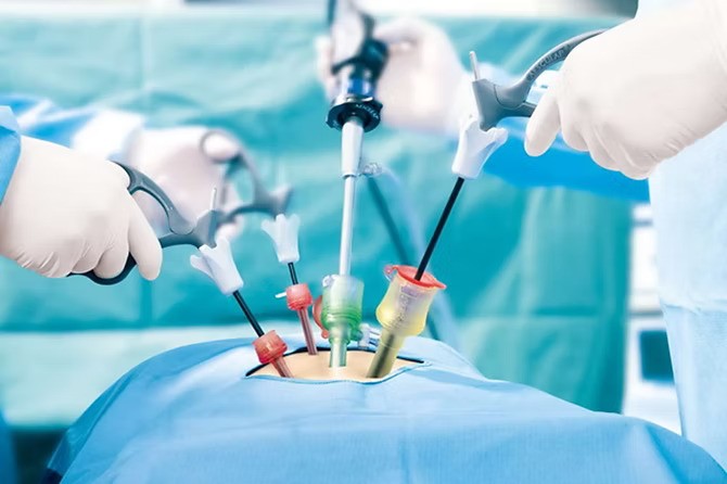 laparoscopic-surgery-in-pakistan