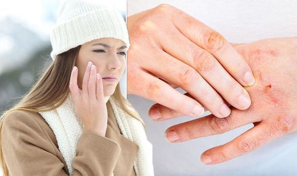 Vitamin E Deficiency