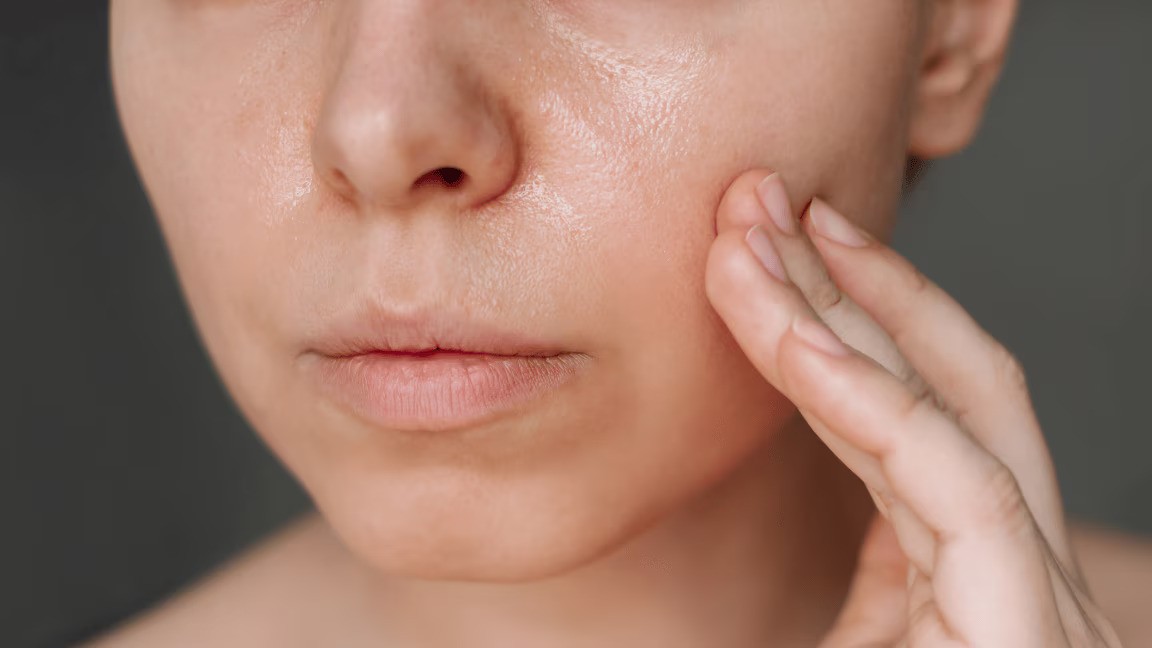 importance-of-sunscreens-for-oil-skin